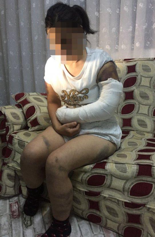 Aldatıldığını düşünen Adanalı adam eşini demirle dövdü