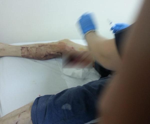 Ordu'da yaşlı adam domuz saldırısında yaralandı