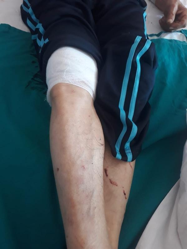 Ordu'da yaşlı adam domuz saldırısında yaralandı