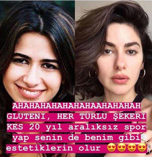 Nesrin Cavadzade'den estetik açıklaması