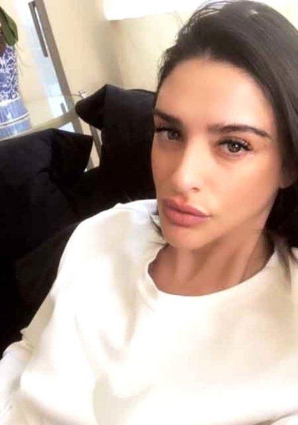 Aslıhan Doğan dudaklarına dolgu yaptırdı