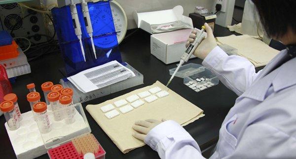 Kök hücre yöntemiyle AIDS tedavi edildi