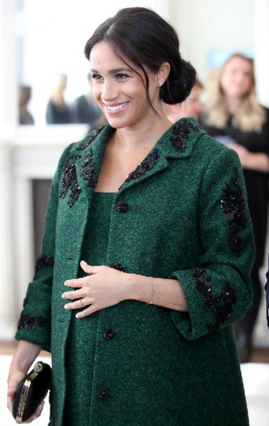 Meghan Markle'ın parmakları şişti