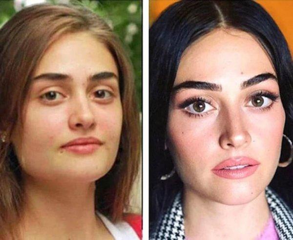 Esra Bilgiç: Estetiğe zerre kadar ihtiyacım yok