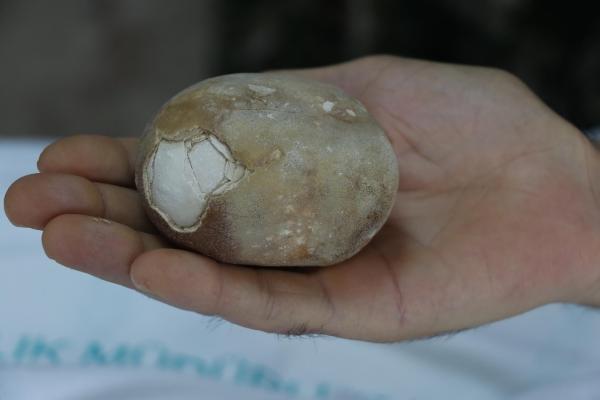 Samsun'da 37 yıllık doktoru şaşırtan taş