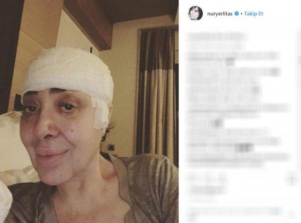 Nur Yerlitaş takipçilerini endişelendirdi