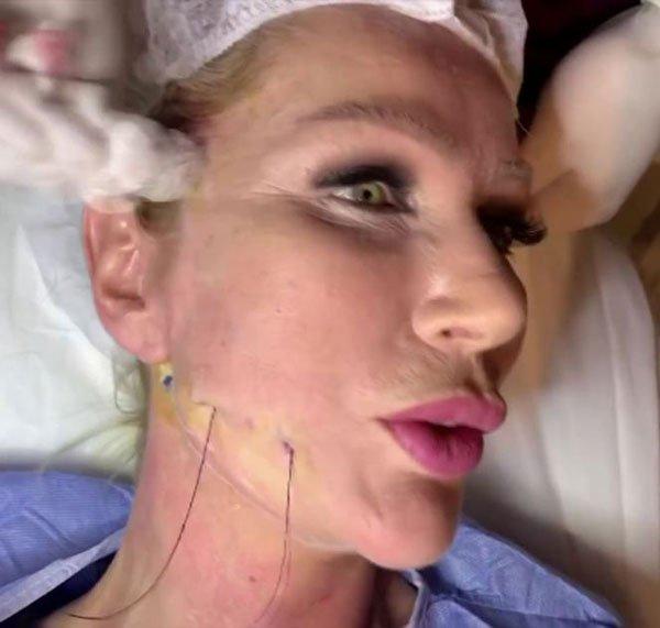 Seda Sayan canlı yayında estetik yaptırdı