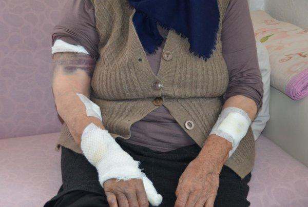 Köpeklerin saldırdığı kadını ölümden komşuları kurtardı