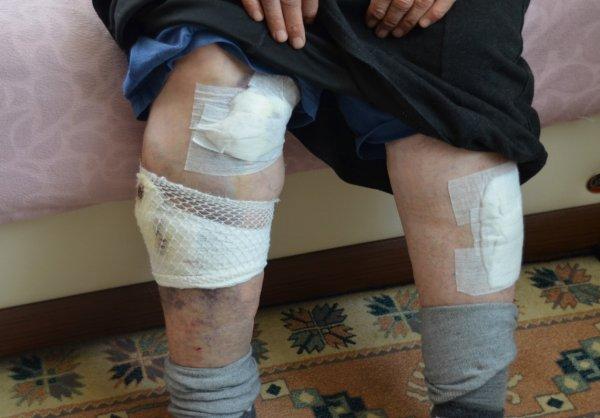 Köpeklerin saldırdığı kadını ölümden komşuları kurtardı