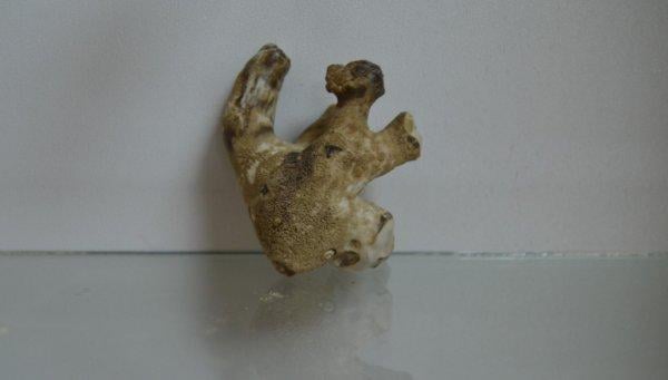 Osmaniye Devlet Hastanesi'nde böbrek taşları sergileniyor