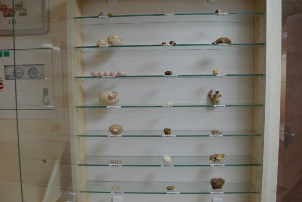 Osmaniye Devlet Hastanesi'nde böbrek taşları sergileniyor