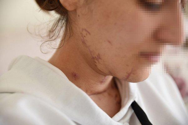 İstanbul'da falçatalı tecavüz davasında iddianame hazır