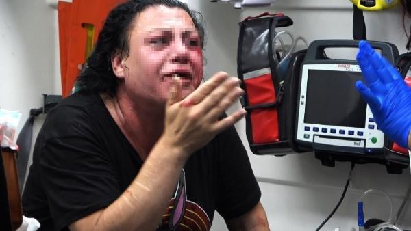 Eskort sitesinde tanıştığı transseksüeli dövdü