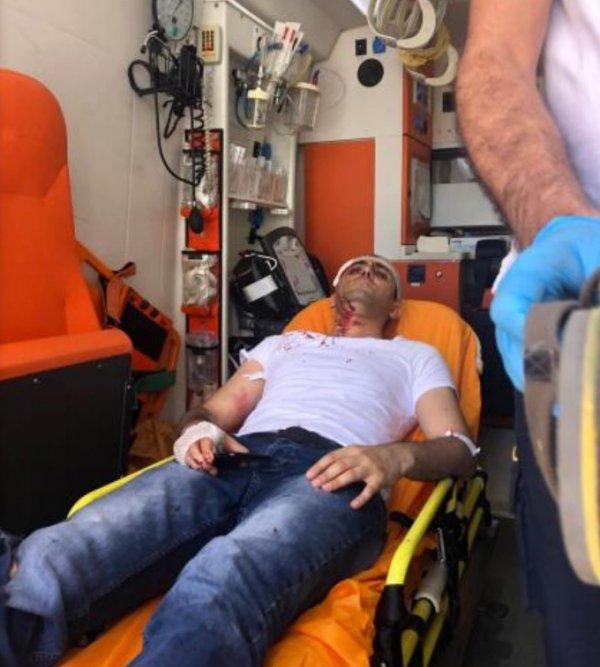 Gazeteci Murat Alan saldırıya uğradı