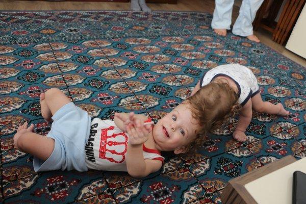 Antalya'da kafadan yapışık siyam ikizleri 1 yaşında