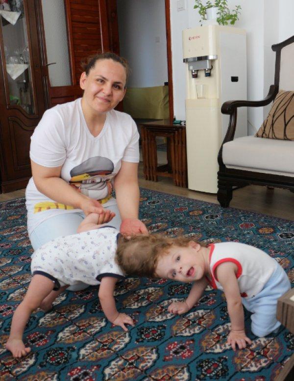 Antalya'da kafadan yapışık siyam ikizleri 1 yaşında