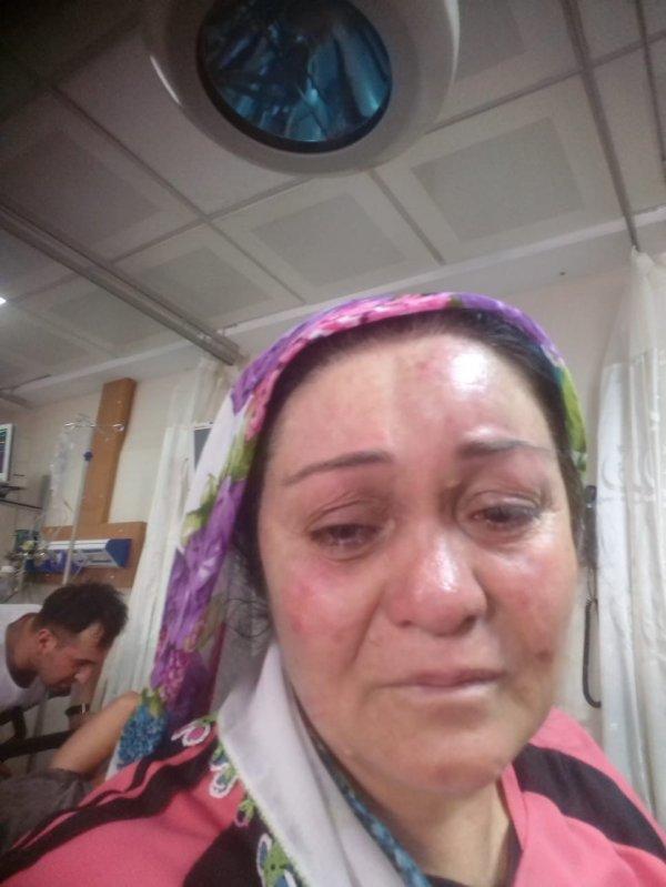 Evi terk eden karısının ailesini de darbetti