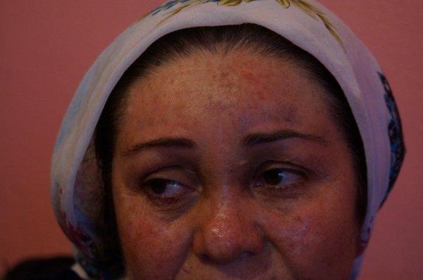 Evi terk eden karısının ailesini de darbetti