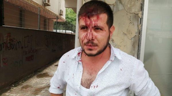 Borcunu almaya gitti, iki kişinin taşla saldırısına uğradı
