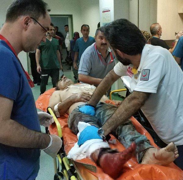 Acemi kasaplar yine kendilerini kesti