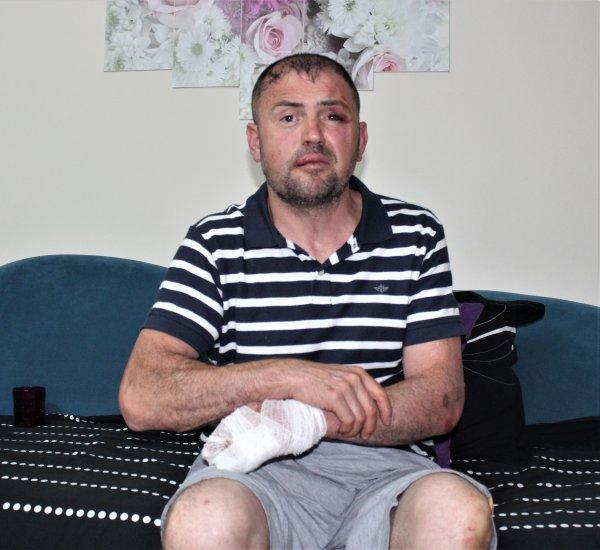 Terör gazisi ayaklarını uzattığı için saldırıya uğradı