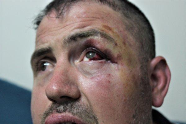 Terör gazisi ayaklarını uzattığı için saldırıya uğradı