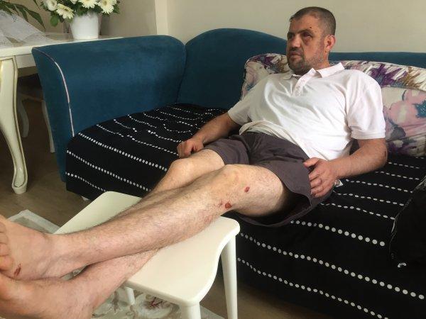 Saldırıya uğrayan gazinin maruz kaldığı yeni skandal