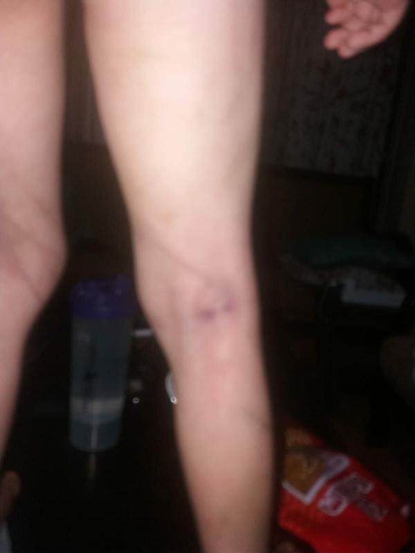 Minik Eymen'in ölmeden önceki son görüntüleri