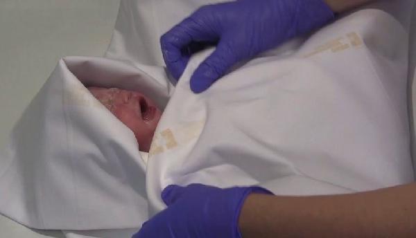 Çekya'da mucizevi doğum