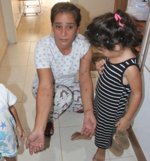 Adanalı kadın birlikte yaşadığı adam tarafından dövüldü