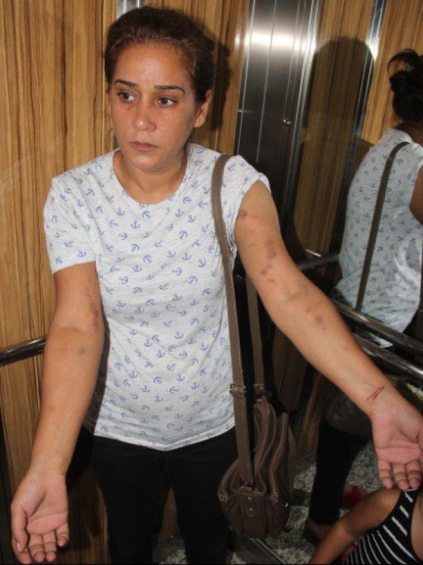 Adanalı kadın birlikte yaşadığı adam tarafından dövüldü