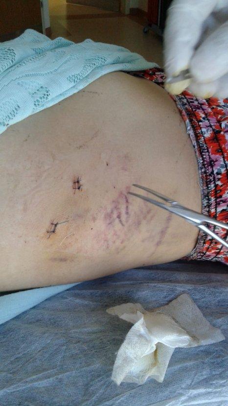 Eşini 15 yerinden bıçaklayan cani hakkında tutuklama kararı