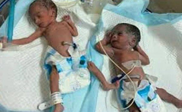 Hindistan'da 73 yaşındaki kadın doğum yaptı