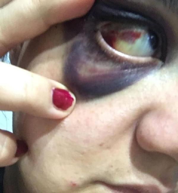 Eşinden dayak yiyen kadın ölümden korkuyor