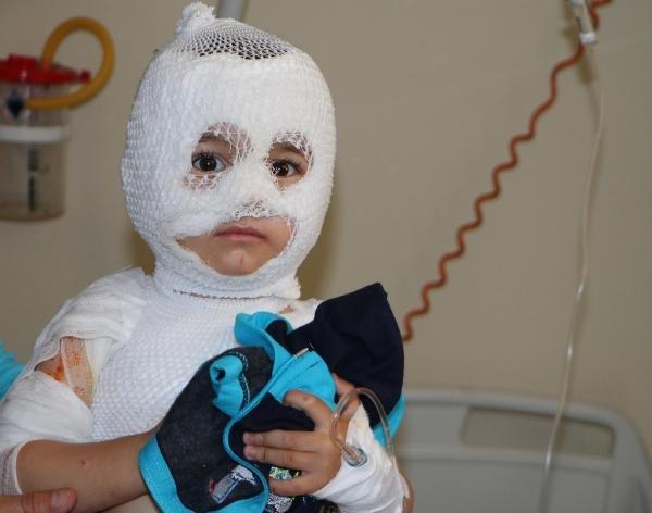 Erzurum'da 2 yaşındaki çocuğun üzerine kaynar su döküldü