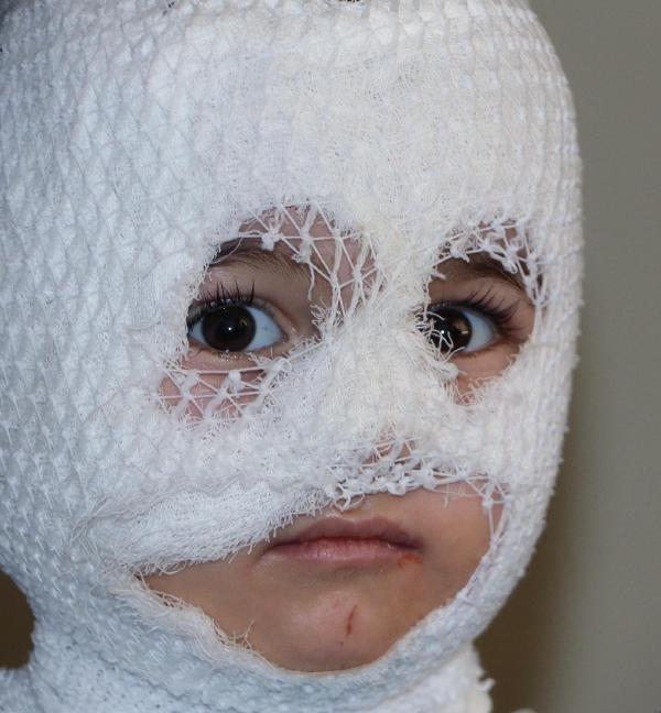 Erzurum'da 2 yaşındaki çocuğun üzerine kaynar su döküldü