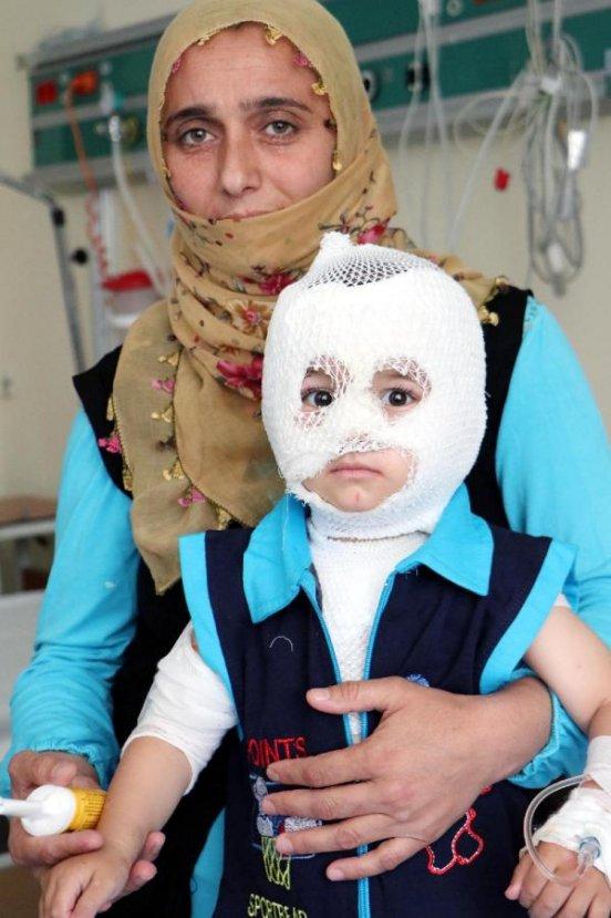 Erzurum'da 2 yaşındaki çocuğun üzerine kaynar su döküldü