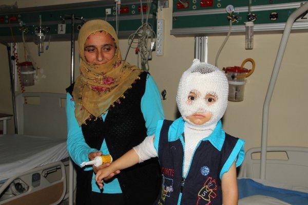 Erzurum'da 2 yaşındaki çocuğun üzerine kaynar su döküldü