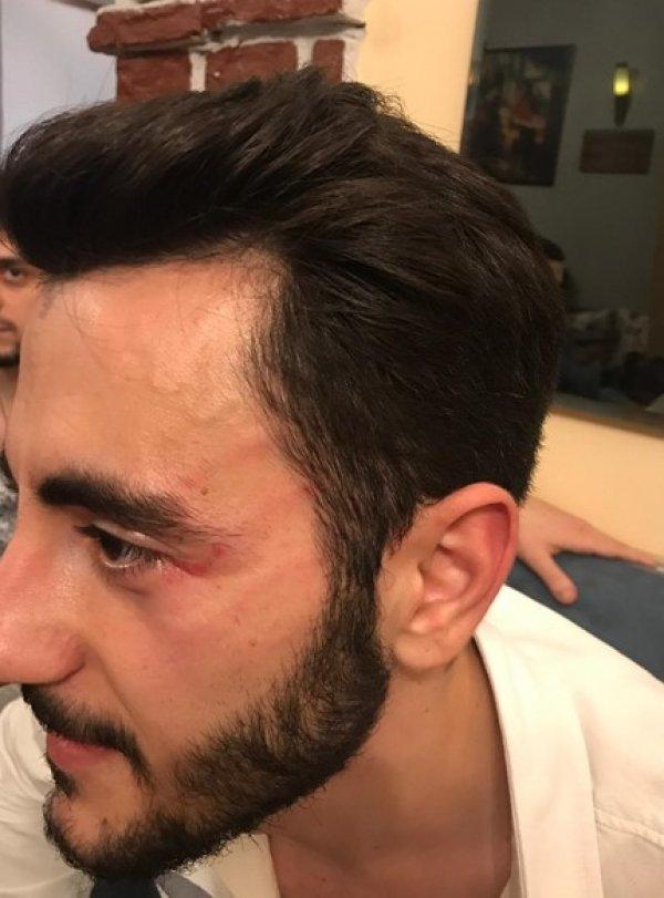 Reynmen, Show TV muhabirini dövdü