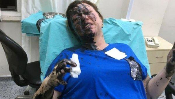 Adana'da darbedilen müteahhit hastaneye kaldırıldı