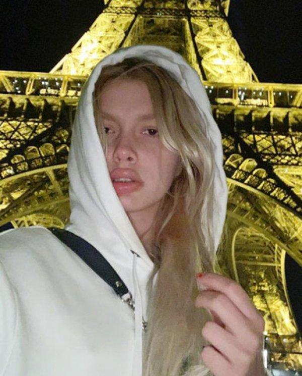 Aleyna Tilki dolgu yaptırdı