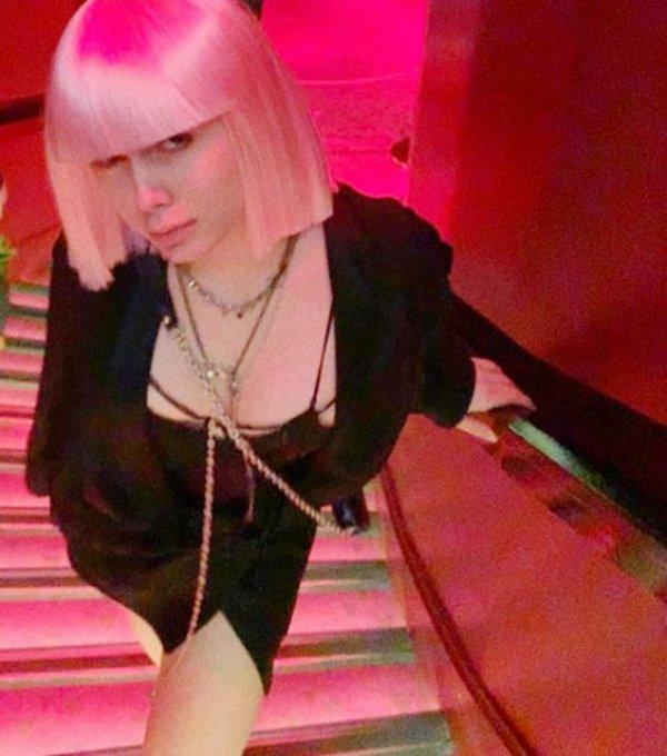 Aleyna Tilki dolgu yaptırdı