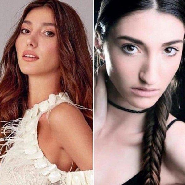 Yeni Türkiye Güzeli, estetik istemiyor