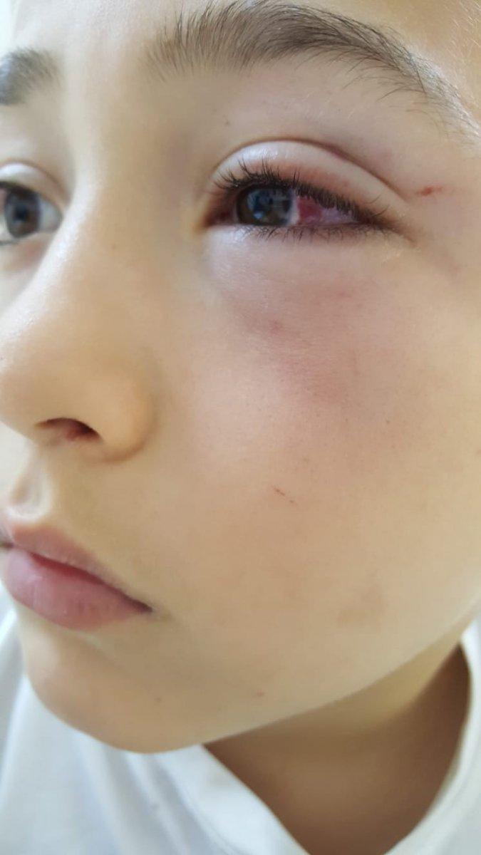 Oğluyla tartışan 9 yaşındaki çocuğu yumrukla dövdü