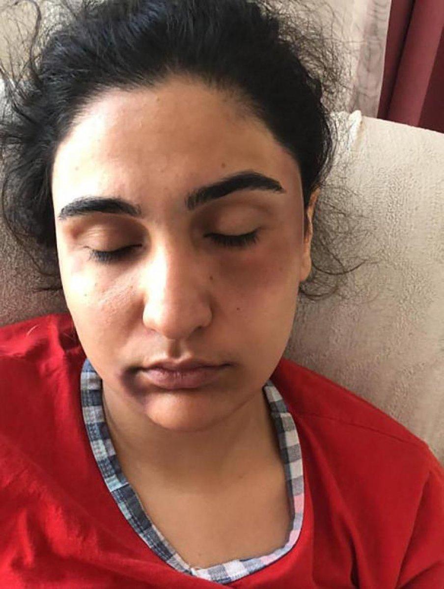 Kocaeli'de kayınpeder dehşeti