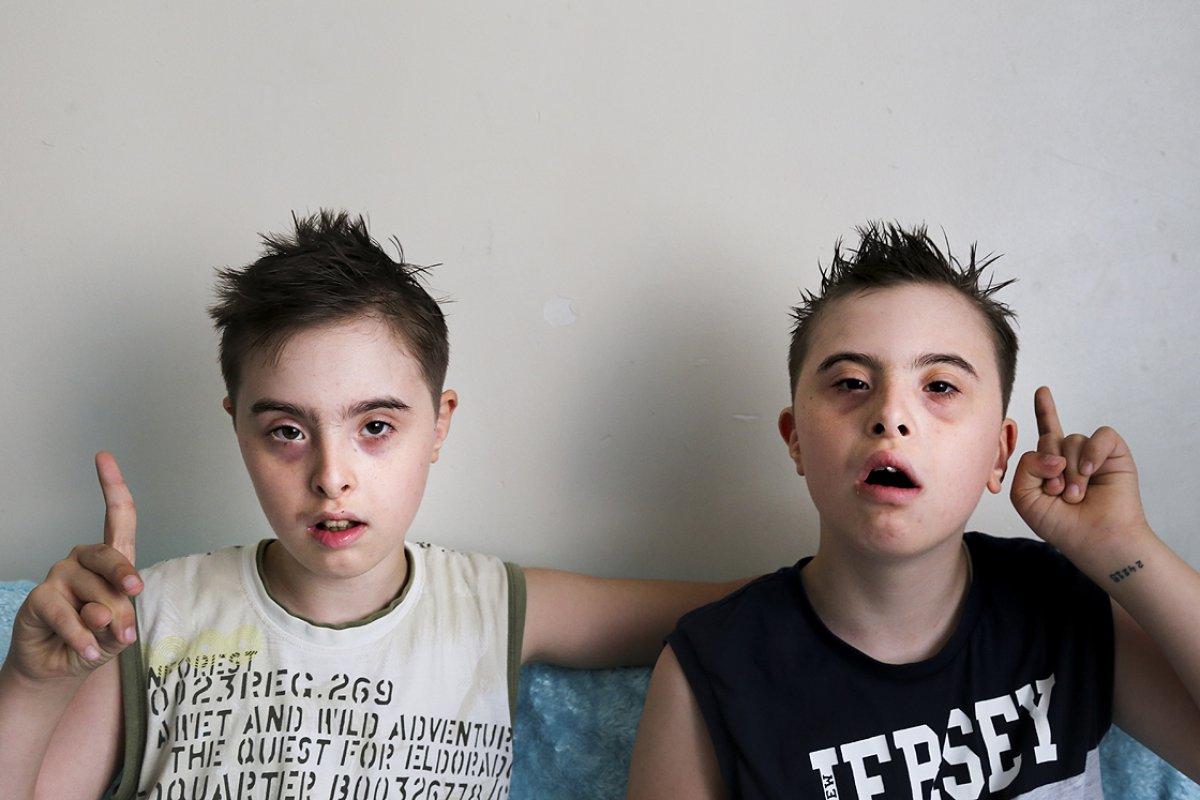 Down sendromlu ikizlerin annesi: Seçilmiş bir aileyiz