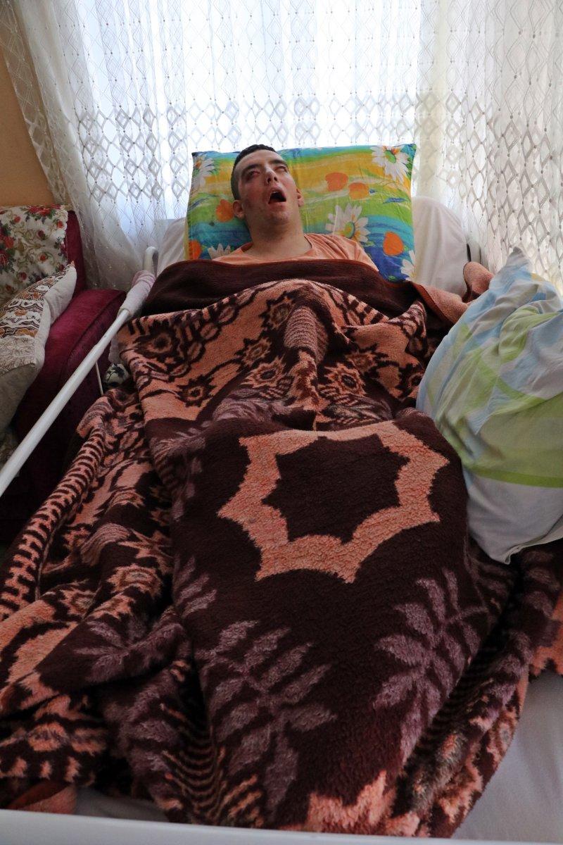 28 yaşında hastalığından yatağa mahkum oldu