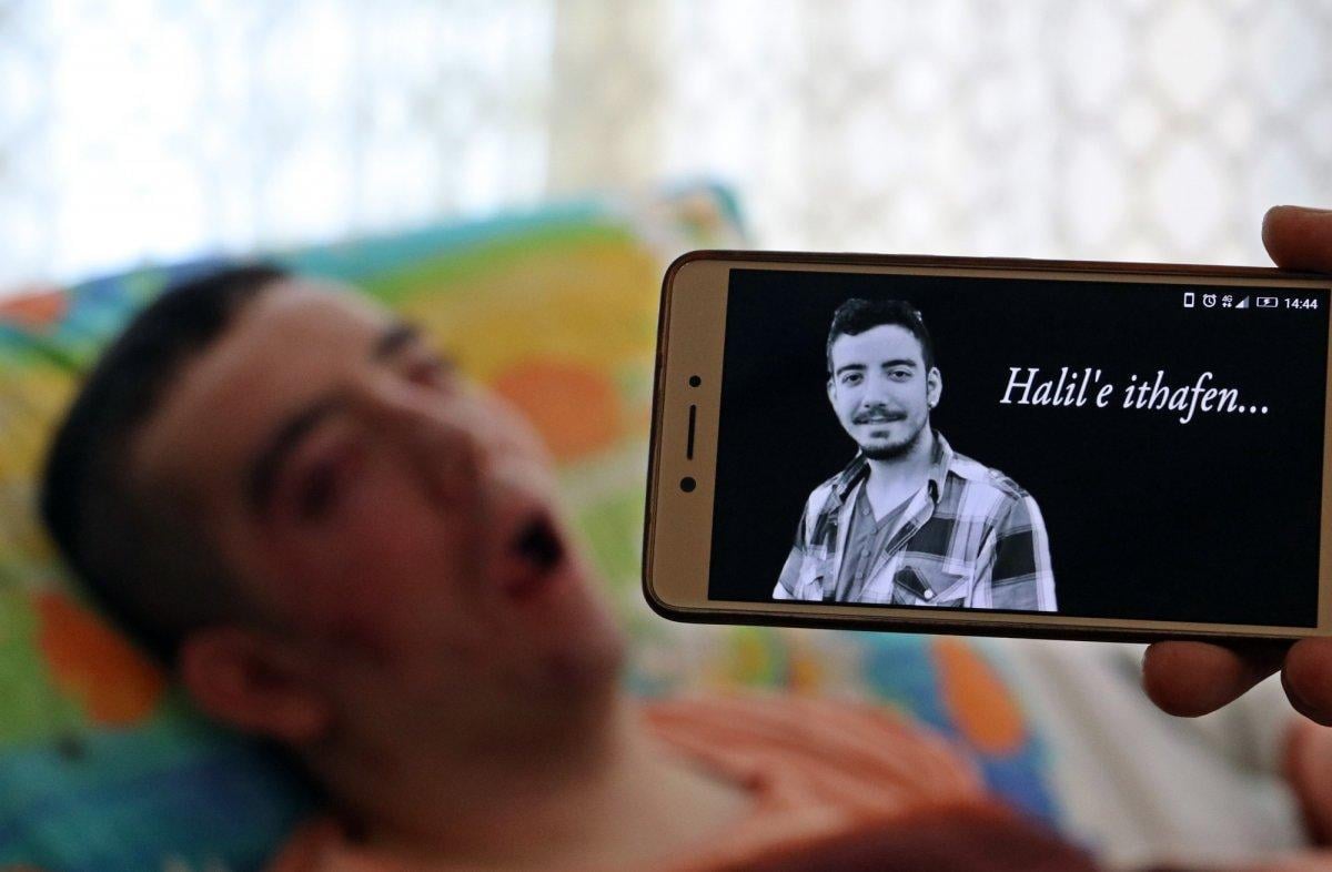 28 yaşında hastalığından yatağa mahkum oldu