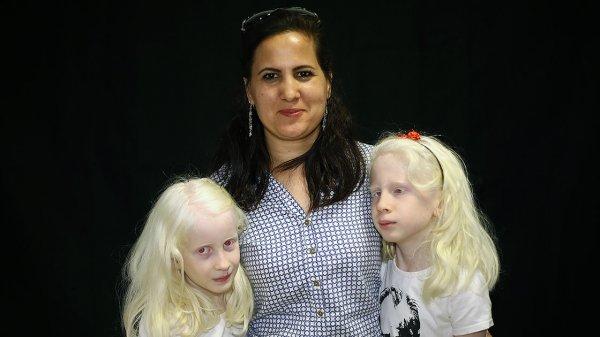 Adanalı albinolar, 4 mevsim gölge arıyor