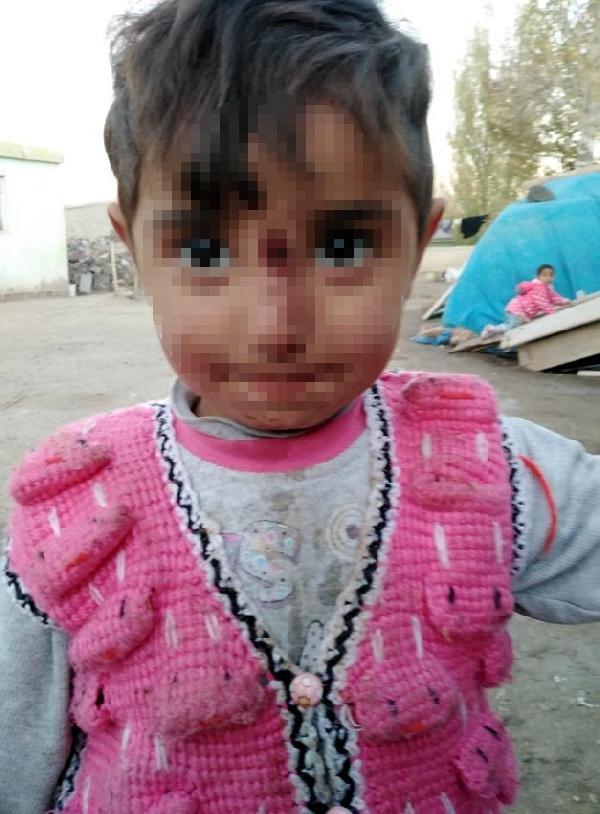 Eşini ve kızını naylon poşetle yaktı